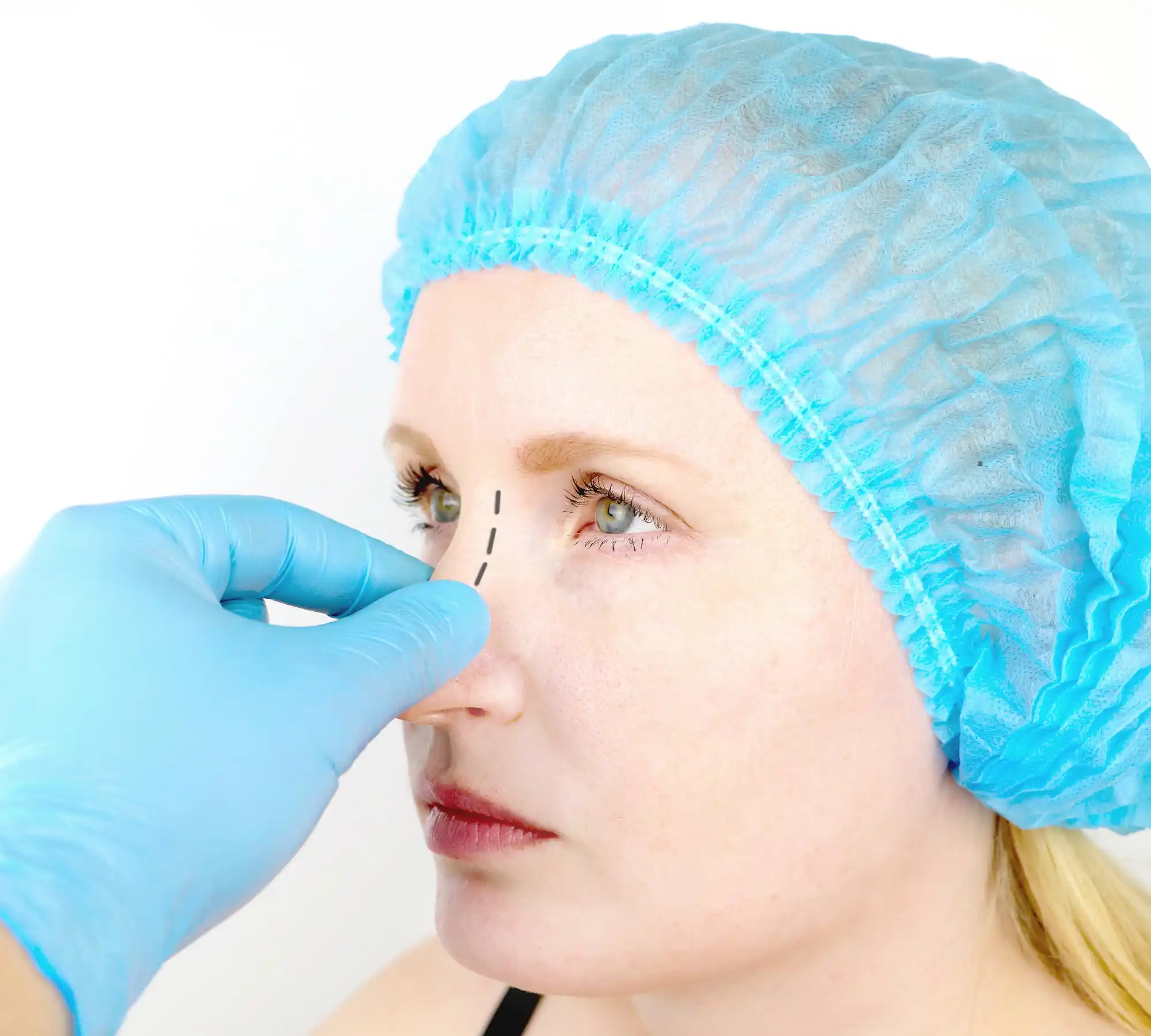 Rinoplasti Öncesi Hazırlık Kontrol Listesi